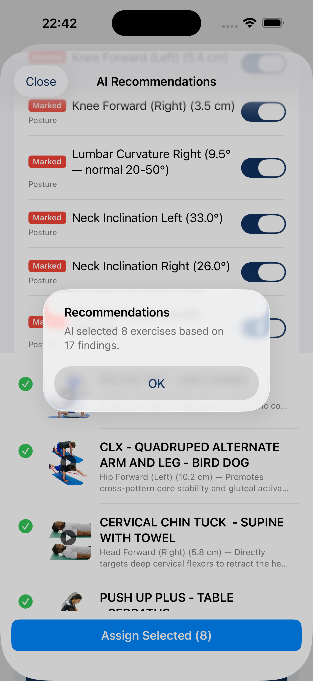 AI Recommendations